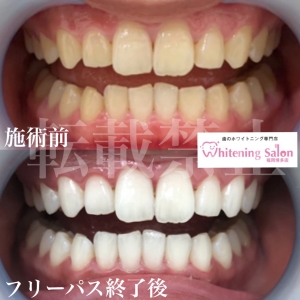 【着色の種類】