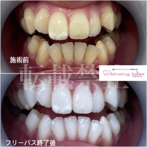 【健康な歯を保つために】