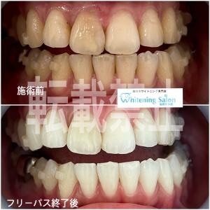 【口腔内のトラブル】