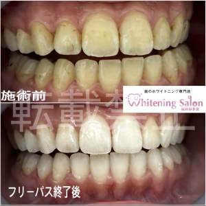 【フリーパスコースのメリット】