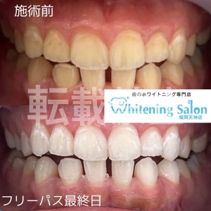 【間違ったケア】