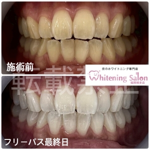 【ながら食べは虫歯の原因に】