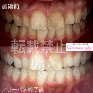 【飲み物の種類】