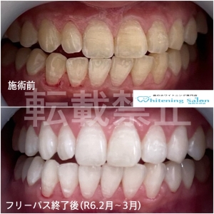 【よく噛むと若返る？！】