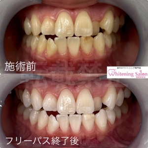 【おすすめの飲み物】博多/ホワイトニング